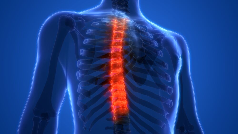 osteochondrose van de thoracale wervelkolom