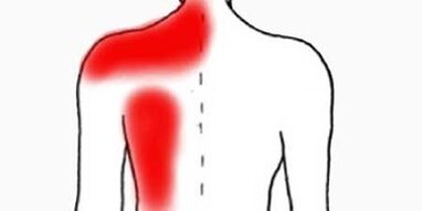 pijn onder het linkerschouderblad vanaf de achterkant