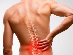 lage rugpijn als gevolg van osteochondrose